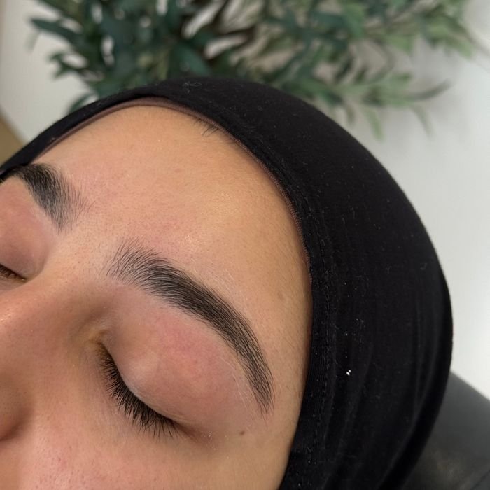 Restructuration des sourcils
